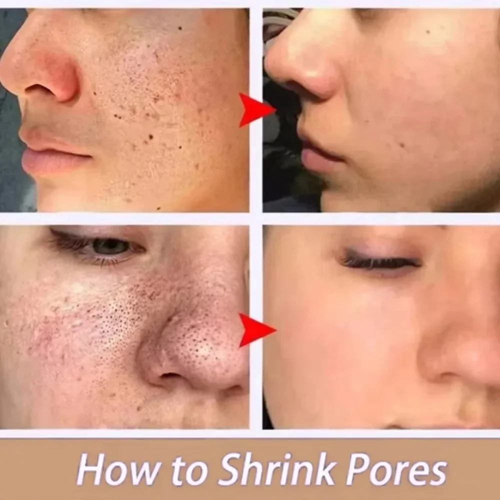 Lactic Acid Pore Refining Serum – Smooth, Tighten & Repair Skin