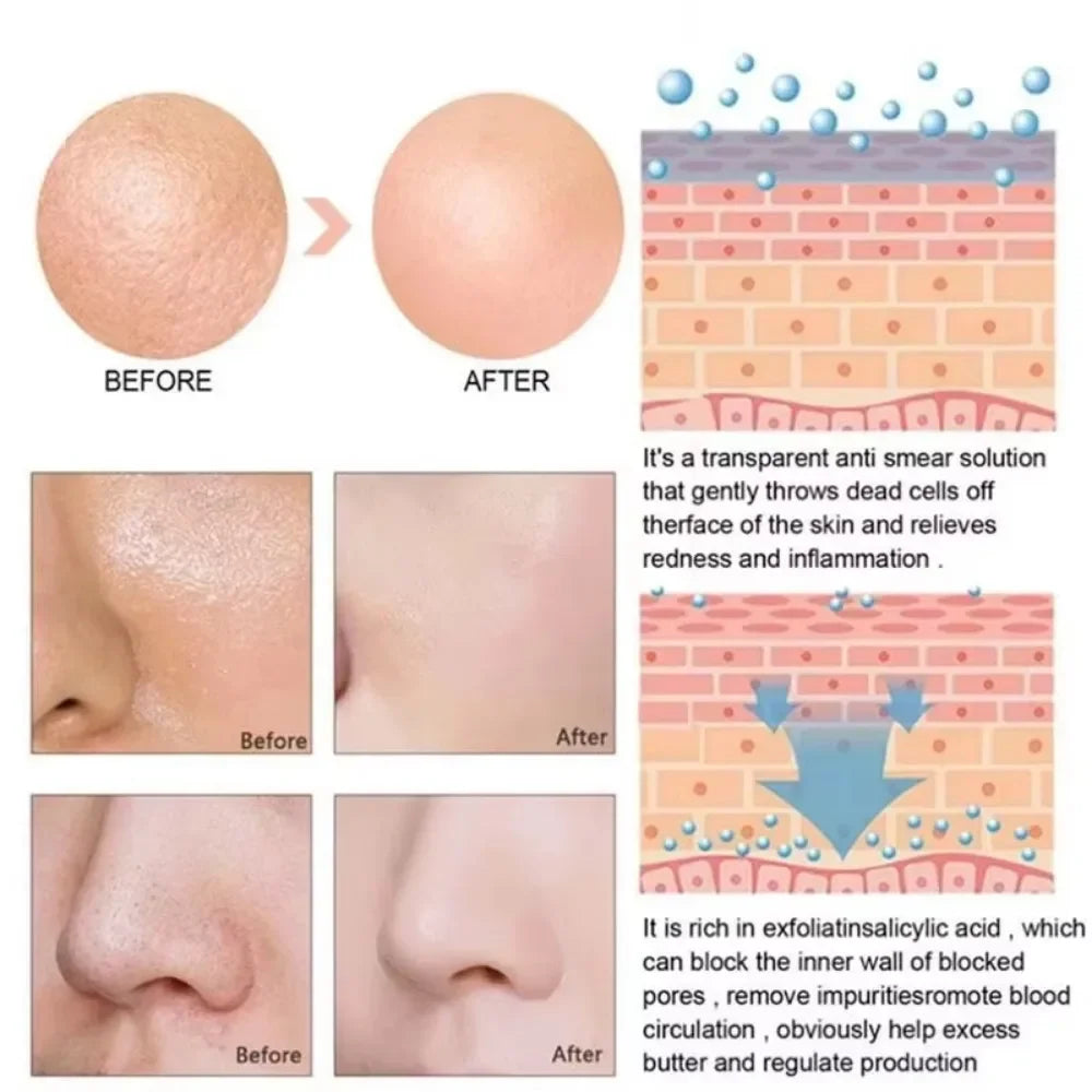 Lactic Acid Pore Refining Serum – Smooth, Tighten & Repair Skin